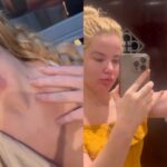 Marcela Tomaszewski divulga novos registros de suposta agressão de Dado Dolabella